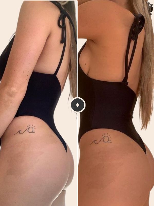 Before/After spray tan 4